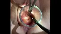 Jouer Gyno vocalise dans l'utérus